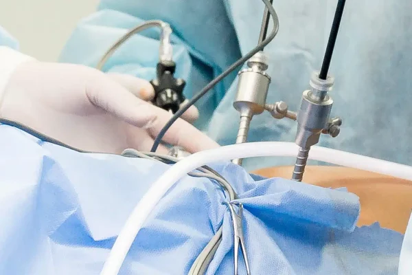 Laparoscopic-Hernia